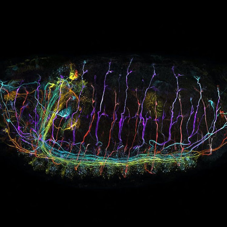 驻马店共聚焦显微镜